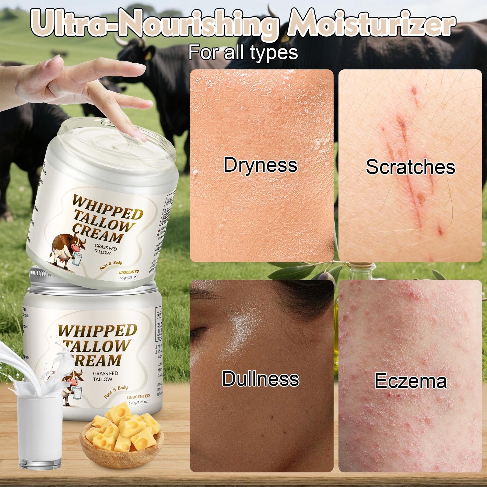 MEIDU Grass-Fed Beef Tallow Skin Cream – Whipped for Face & Body, Deeply Nourishing Moisturizing Cream for Soft, Smooth Skin MEIDU Grass-Fed Beef Tallow Skin Cream – Whipped for Face & Body, Deeply Nourishing Moisturizing Cream for Soft, Smooth Skin