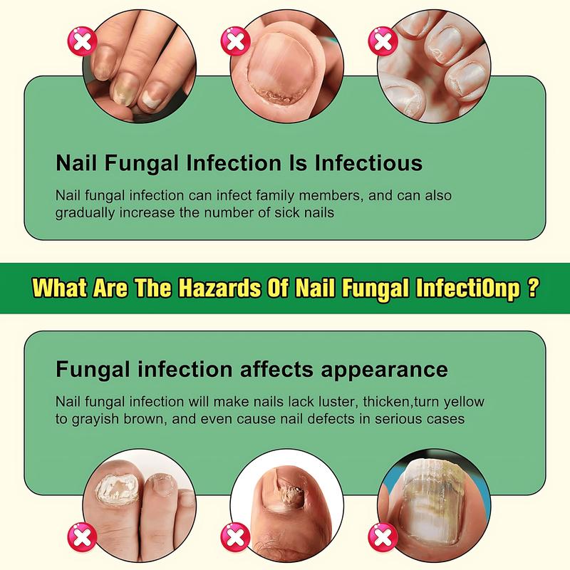 7-Day Nail Fungal Treatment Serum Foot Fungus Remedy Removal Products Anti infection Onychomycosis Paronychia Repair Gel Care Ginger Healthcare Therapeutic Therapy Bathroom Solution nailgrowthoil Healthy Wellness Aid Liquid Fitness Organic Skin Ginkgo