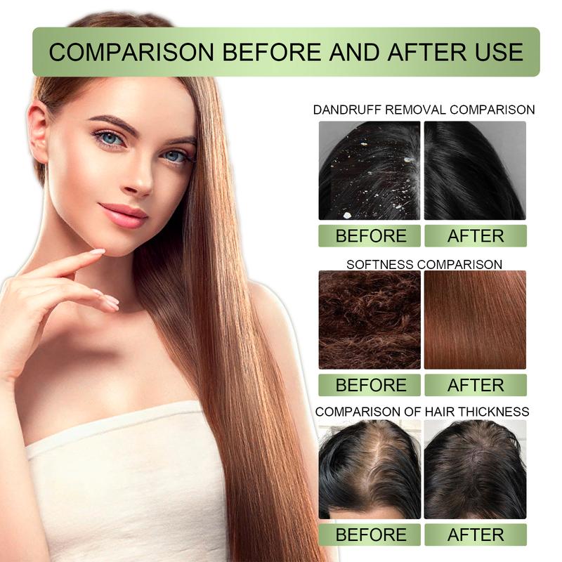 OUHOE Herbal Hair Oil: Gentle in nature, it nourishes the scalp; strengthens and cleanses the hair while protecting the scalp from dandruff and enhancing hair thickness.