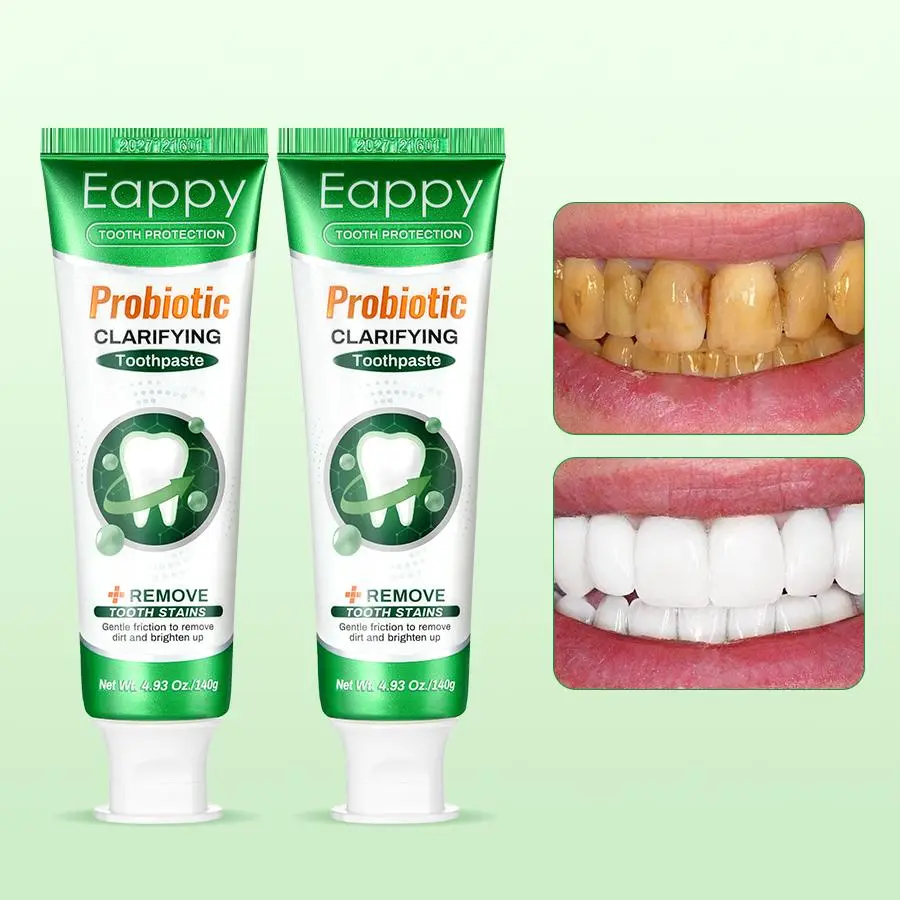 Eappy Tooth Refresh Toothpaste for Fresh Breath Prevent Tooth Loss with ...