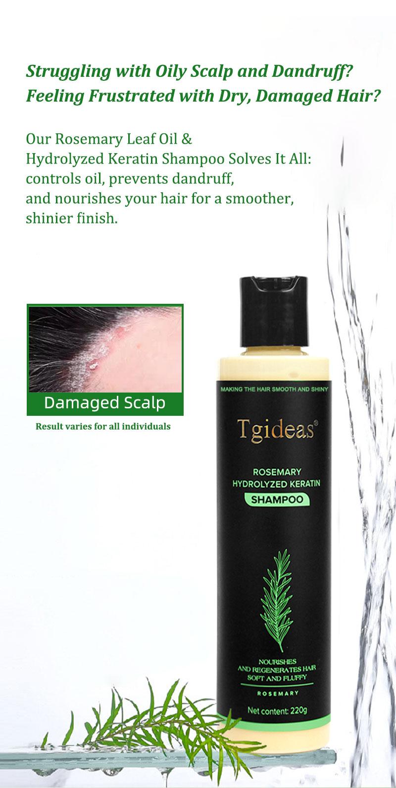 Tgideas Rosemary Shampoo with Hydrolyzed Keratin Promotes Hair Growth Controls Oil Dandruff Soothes Scalp Irritation Restores Shine