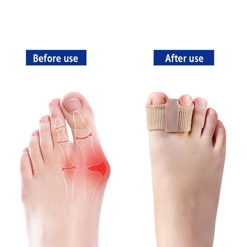 Bunion Corrector for Big Toe - Comfortable Toe Separators - TikTok Shop