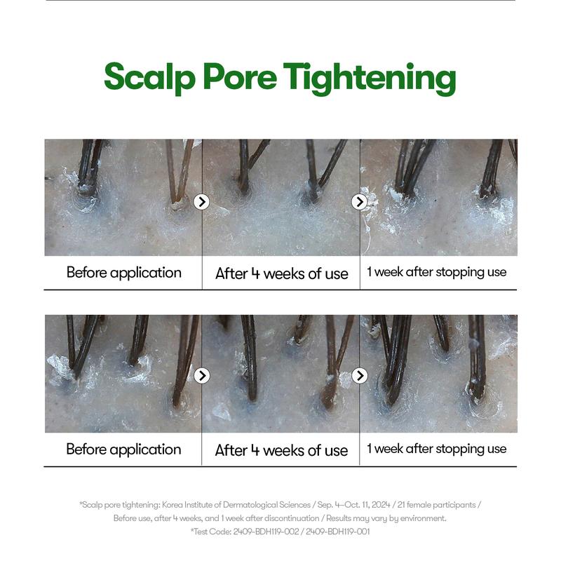 [VT Official] PDRN Reedle Shot Hair Ampoule | Hair Growth Hair loss treatment, Hair Loss Prevention, Scalp Health, OG Liquid Microneedling Reedle Shot, Enhanced Absorption Hair Serum Shot, PDRN & Caffein & Biotin & Rosemary Extract, Anti-aging Scalp No Ri