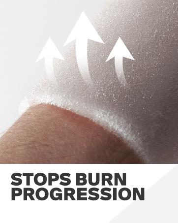 SURVIVEX Burn Dressing Kit with Tea Tree Oil - Hydrogel Burn Pads, Cooling Gels, Non-Adhesive Dressings & Gauze - Complete First Aid for Instant Cooling, Soothing & Relief SURVIVEX Burn Dressing Kit with Tea Tree Oil - Hydrogel Burn Pads, Cooling Gels, Non-Adhesive Dressings & Gauze - Complete First Aid for Instant Cooling, Soothing & Relief