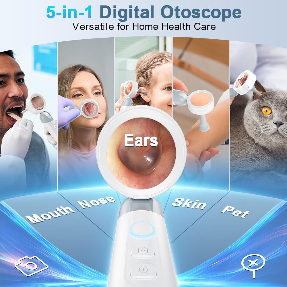 【2026 Upgrade】Aspoven Digital Otoscope with LED Light, 1.4" IPS Screen, 1080P HD Ear Scope for Kids, Adults & Pets, 12 Silicone Specula Tips, Photo & Video Recording, Type-C Rechargeable Ear Wax Removal Tool