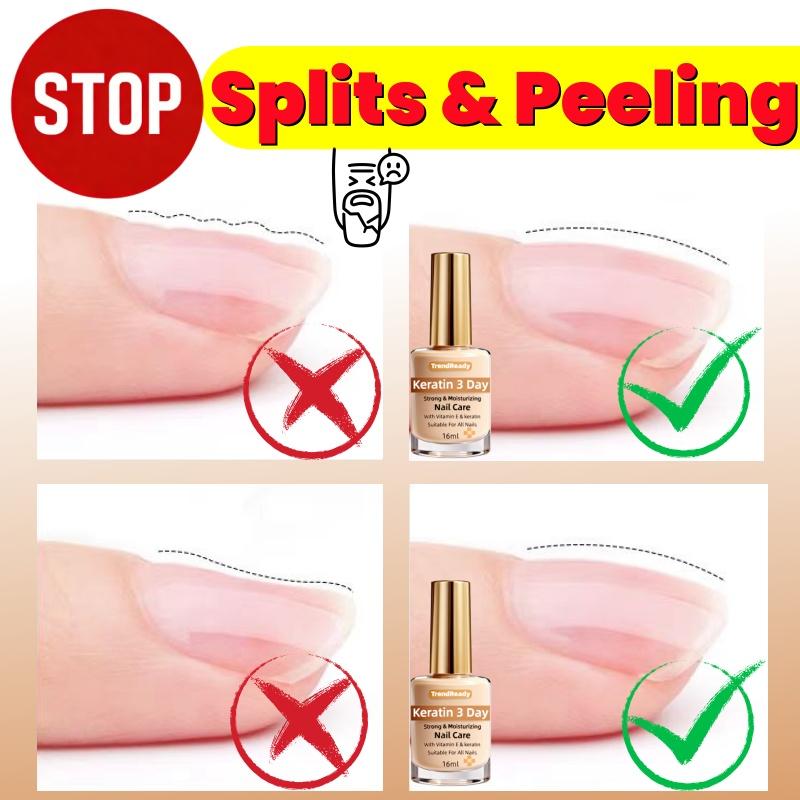 2PCS Nail Strengthener for Weak, Splitting, Breaking Nails - Fast Dry Keratin & Natural Protein Hardener, 4-in-1 Nail Polish Care Oil, Alcohol-Free Formula for Instant & 3-Day Nail, Manicure for Hands & Fingers