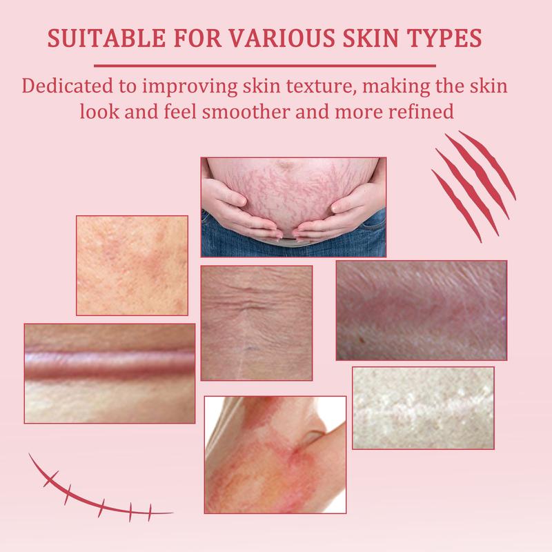 MAYLOR Scar Cream, Professional Scar Removal Gels - Advanced Silicone Scar Removal Cream for Burn, Acne Old Scar Removal Cream for Face & Body, Fades Dark Scars