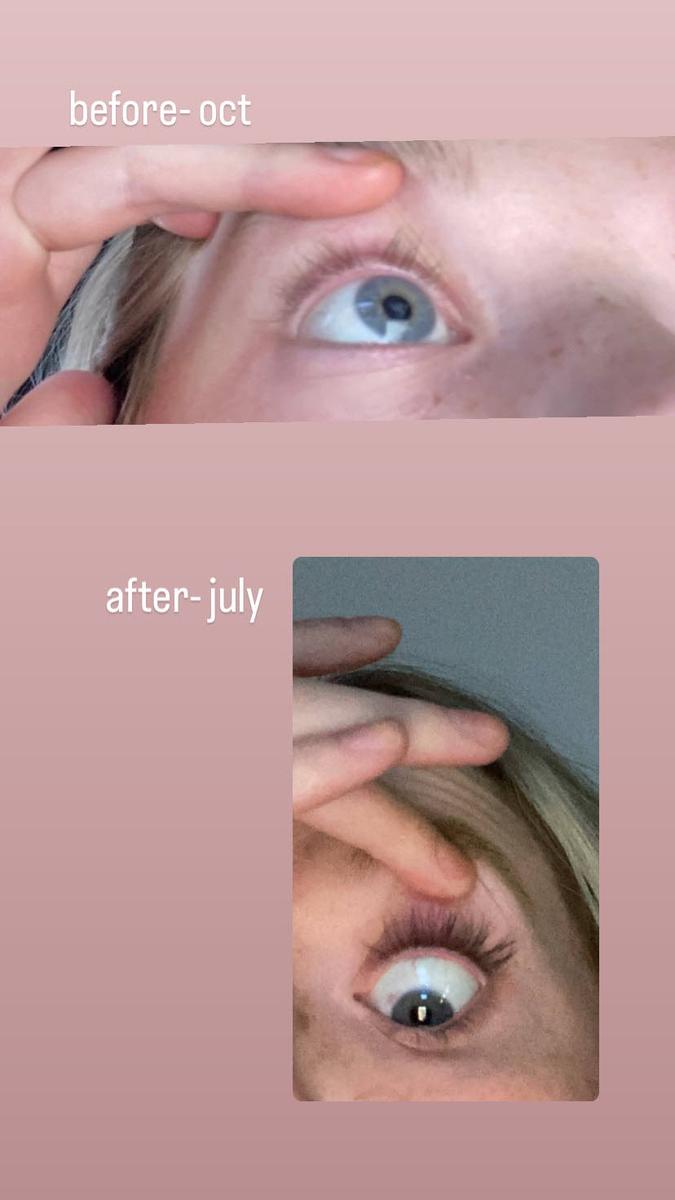 Item: 3 Month Supply (2 mL)