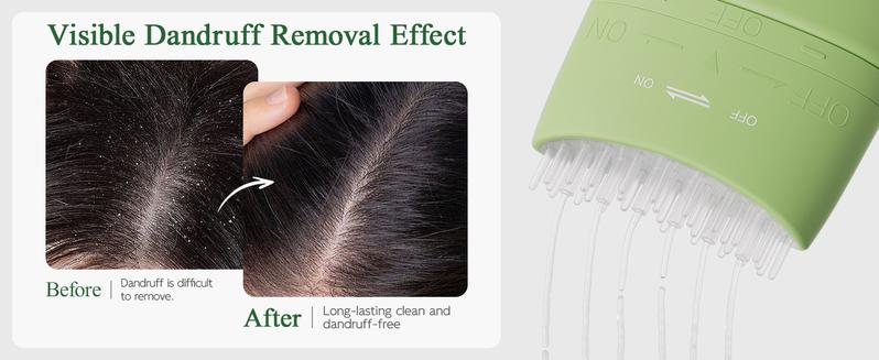 Ropink Mugwort Scalp Detox 10% Bifida Ferment & OCT Anti-Dandruff Pre-Wash | Soothing Serum with Silicone Massage Tip Ropink Mugwort Scalp Detox 10% Bifida Ferment & OCT Anti-Dandruff Pre-Wash | Soothing Serum with Silicone Massage Tip