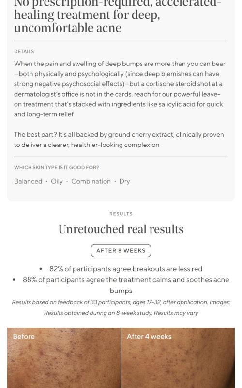 Deep Relief Acne Treatment 2-Pack