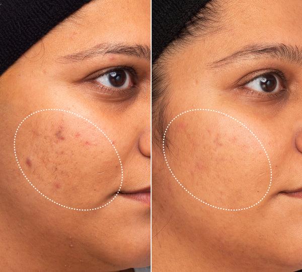 INNBEAUTY PROJECT Green Machine Serum - Dark Spot Corrector with Vitamin C, Azelaic Acid, & 15 Superfoods for Radiant Skin