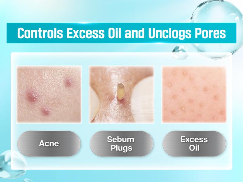 [numbuzin official shop] No.1 Cream | Pantothenic B5 Active Soothing Cream | 2.70 fl oz.