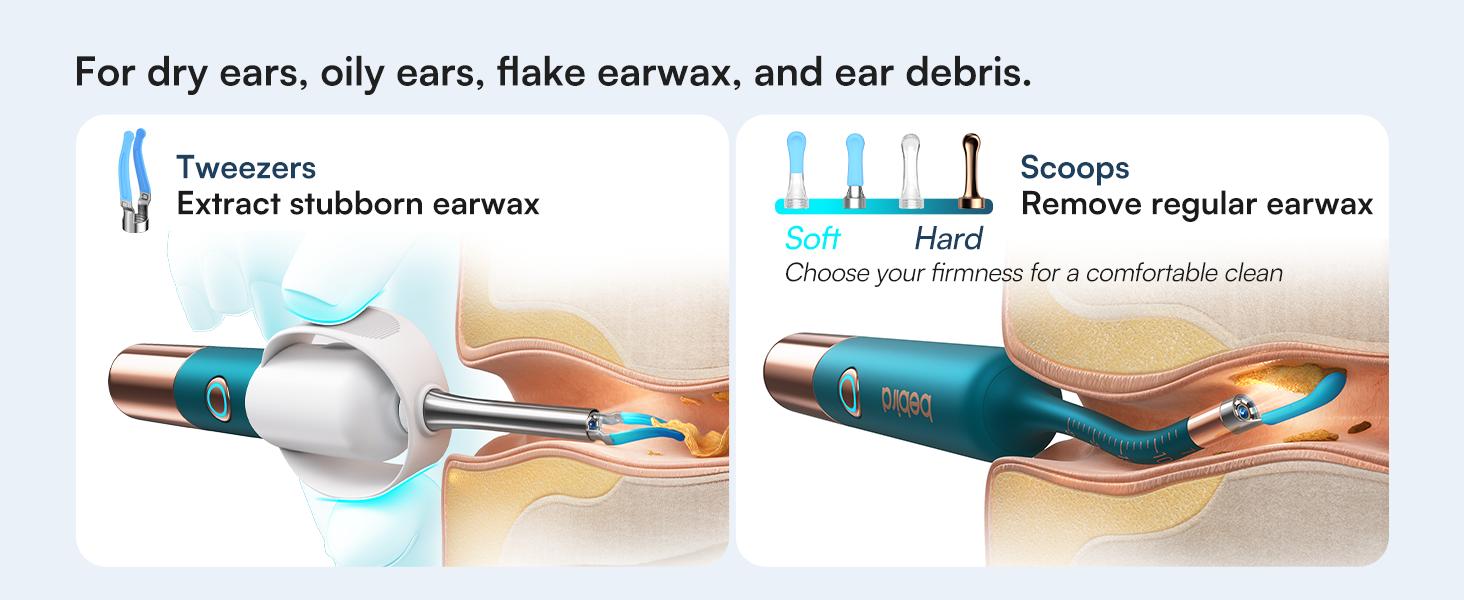 【Theatrical-Grade】Bebird Earsight Ultra Ear Wax Removal Tool , Ear Cleaner with Flexible Ear Camera Otoscope, Painless Visual Ear Pick Tweezers, Visual Scope Earwax Cleaning Dropper, Ear Cleaning Kit for Family