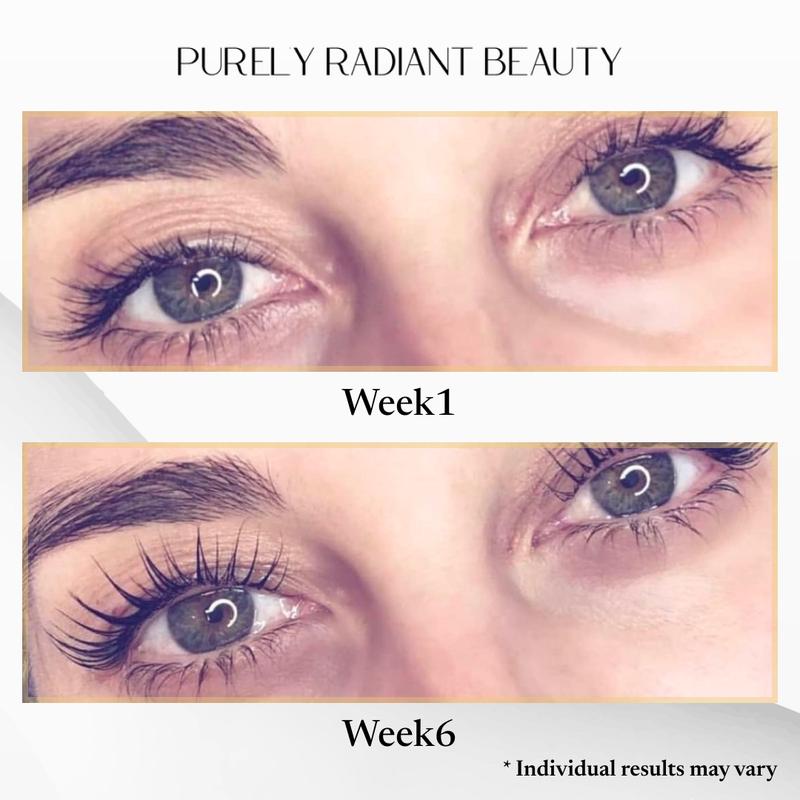Purely Radiant Beauty Viral Lash & Brow Growth Serum – Organic, Vegan, Prostaglandin-Free – Thicker Longer Lashes – Castor + Rosemary Oil – TikTok Favorite- 75K+Sold
