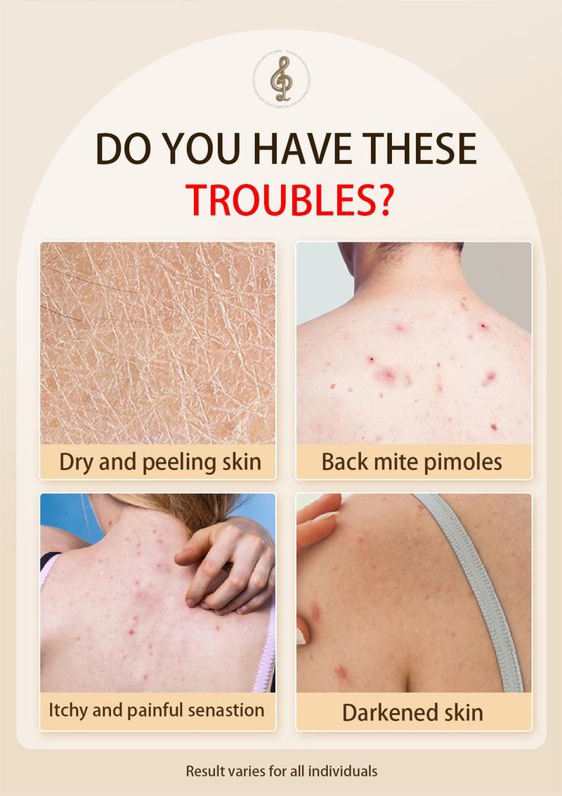 Buy 1-Get 1 Free! Tgideas Sulfur Body Wash - Deep Oil Control + Anti-Itch and Anti-Acne | Plant-Based & pH Balanced | 72-Hour Refreshing Fragrance | Fights Breakouts, Oiliness, and Odor