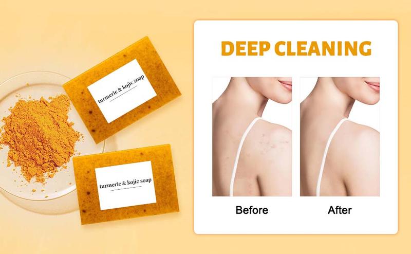 3PCS Turmeric Soap Lush Valentines Deep Cleansing Moisturizing Soap For Face Body Body Wash Soap For Women Men