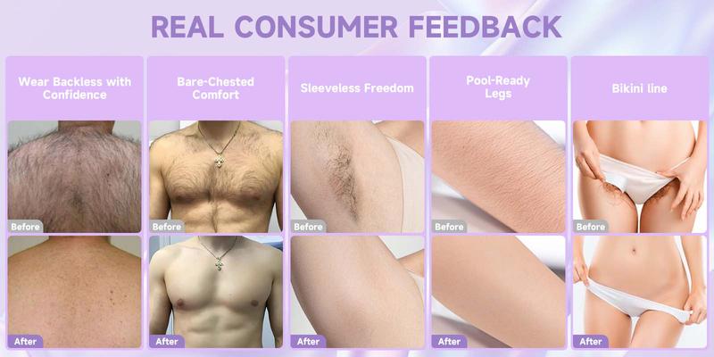 Bikini Pain-Free Hair Removal Cream for Sensitive Skin, Hypoallergenic Formula-Gentle & Fast-Acting Depilatory with Citrus Scent, Aloe & Hyaluronic Acid for Soothing Care, Suitable for Men & Women