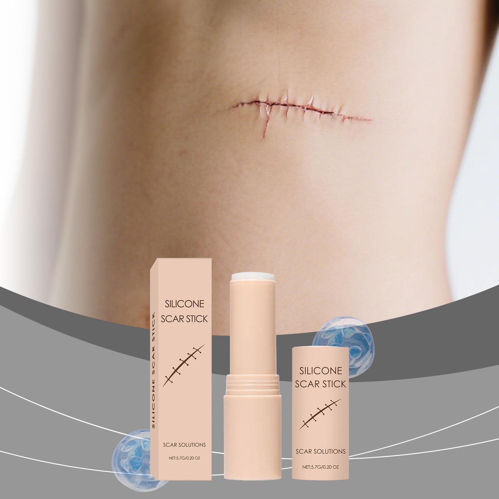Scar Solutions Silicone Scar Stick for Face and Body 60% Soothing Moisturizing Gentle on All Skin Types Easy-to-Use Stick Design 6g
