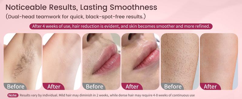 LILA Dual-Head Mini Electric Beard Shaver – Waterproof Rechargeable 2-in-1 Razor, Portable Full Body and Facial Epilator for Painless Trimming of Pubic Hair, Face, Underarms and Legs – 2025 New Shaver,Christmas gifts,New Year's gifts