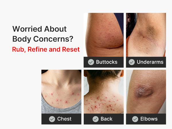 [medicube] Kojic Acid Turmeric Peel Shot Duo For Face & Body | Brightening Reset Gentle Exfoliating Serum with BHA, LHA & PHA for Dead Skin Cells, Blackheads & Excess Sebum | For Dull, Rough & Troubled Skin