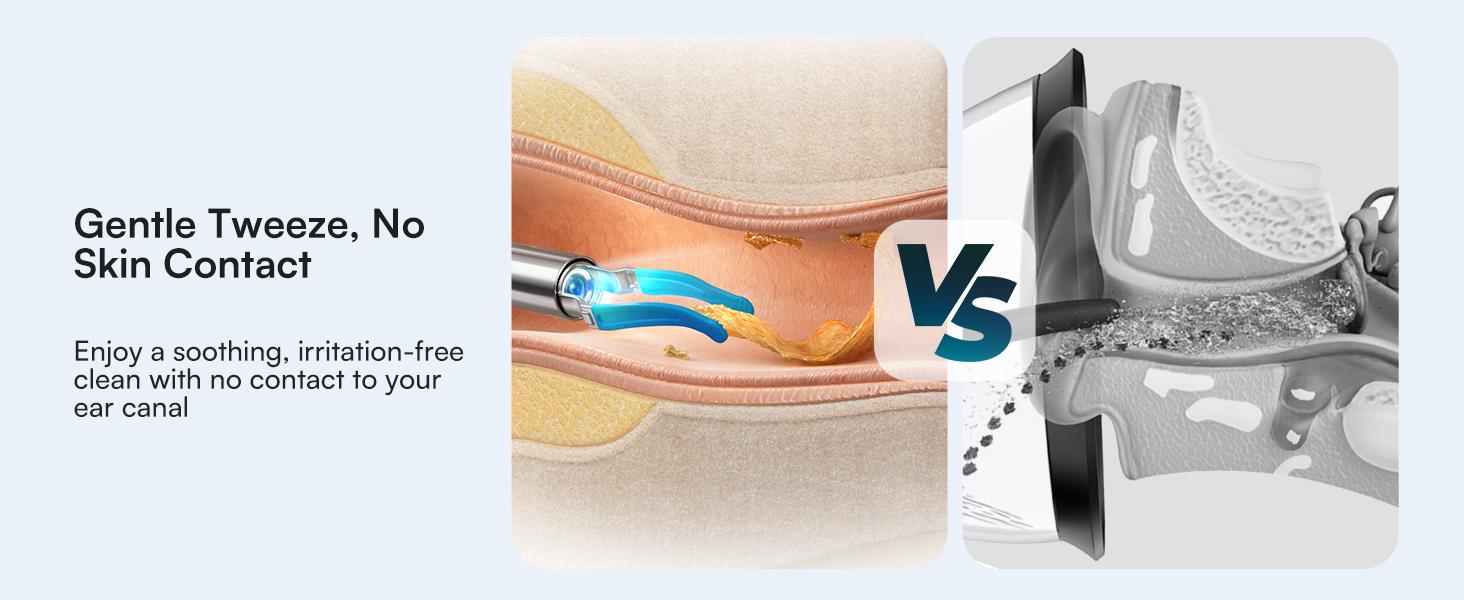 【Theatrical-Grade】Bebird Earsight Ultra Ear Wax Removal Tool , Ear Cleaner with Flexible Ear Camera Otoscope, Painless Visual Ear Pick Tweezers, Visual Scope Earwax Cleaning Dropper, Ear Cleaning Kit for Family