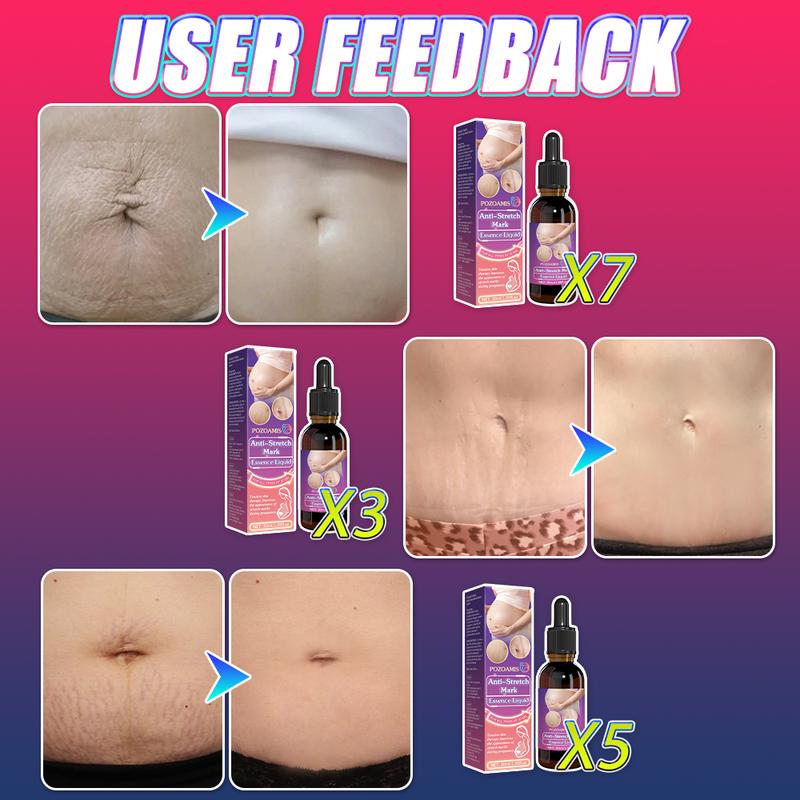 Stretch Mark Repair Serum: Fades stretch marks, moisturizes the skin, and improves skin elasticity. Apply to affected areas to revitalize the skin and prevent the formation of new stretch marks. Stretch Mark Repair Serum: Fades stretch marks, moisturizes the skin, and improves skin elasticity. Apply to affected areas to revitalize the skin and prevent the formation of new stretch marks.