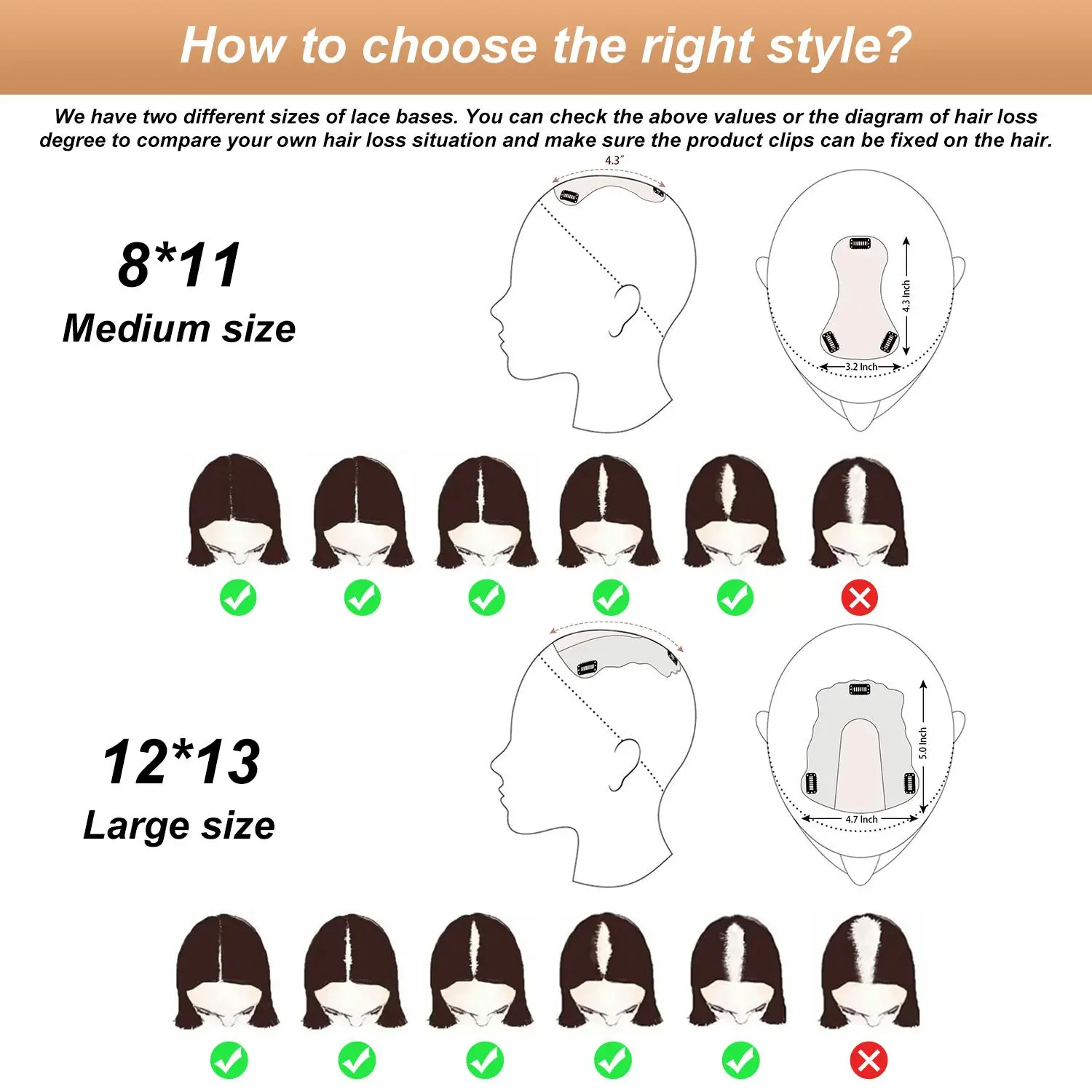 【Don't Buy, Free Gift-Style recommendation service】For the color and size selection of hair topper, for the uncertain buyers, you can contact customer service to help choose the right style.【 can directly contact customer service or homepage after-sales】