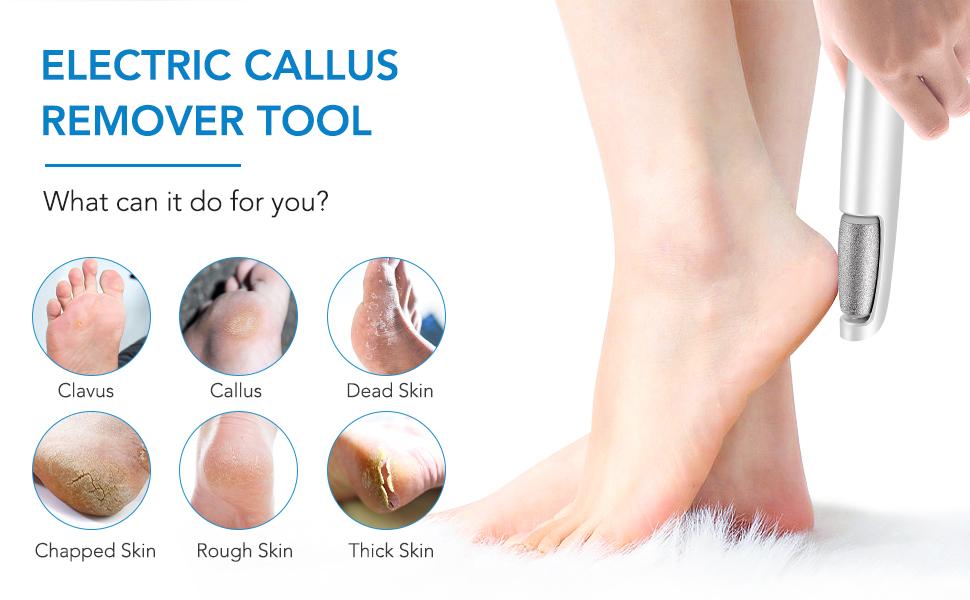 LINKEVAP Electric Feet Callus Remover,Portable Electronic Foot File Pedicure Tools,Waterproof Foot Scrubber File,Pedi Foot Care for Dead,Hard Cracked Dry Skin Manicure Nail Nail Care Cutics Nail Art LINKEVAP Electric Feet Callus Remover,Portable Electronic Foot File Pedicure Tools,Waterproof Foot Scrubber File,Pedi Foot Care for Dead,Hard Cracked Dry Skin Manicure Nail Nail Care Cutics Nail Art