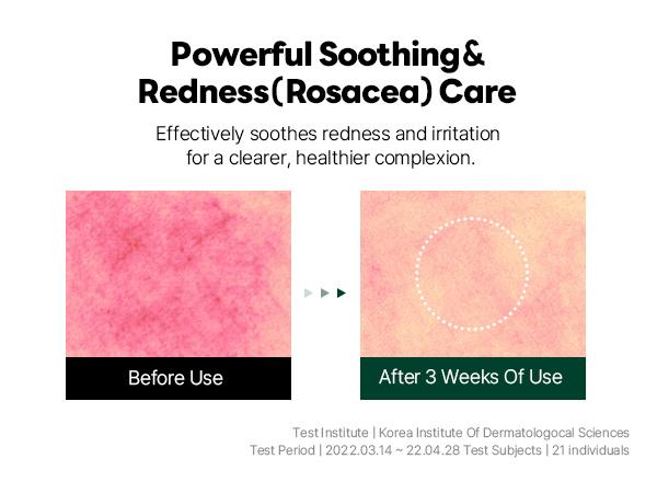 Pine Calming Cica Ampoule - 30ml for Skin Repair and Redness Care