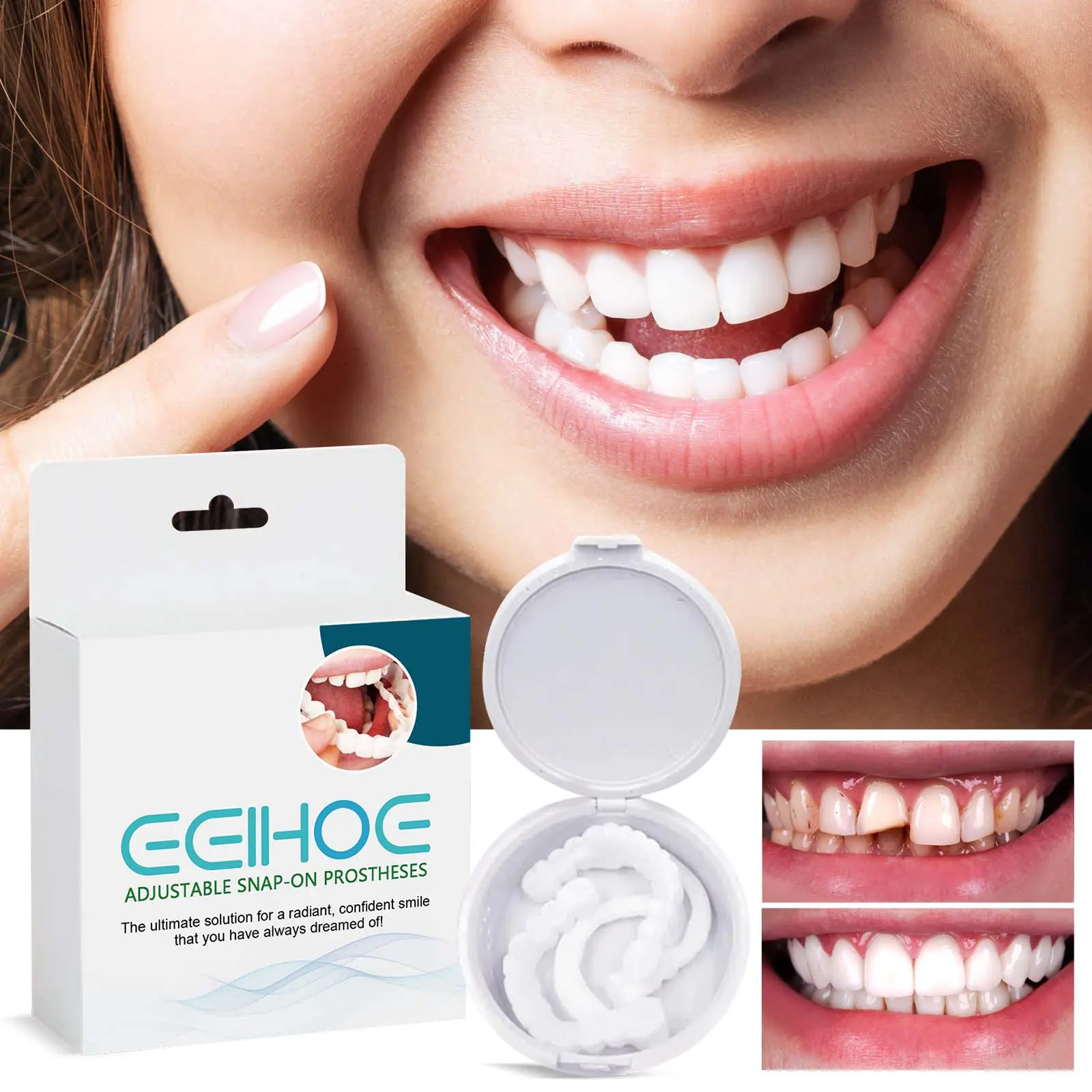 EELHOE Adjustable Buckle Dentures, Modified Teeth Interdental Set Orthodontic Dentures Set Oral adjustable snap