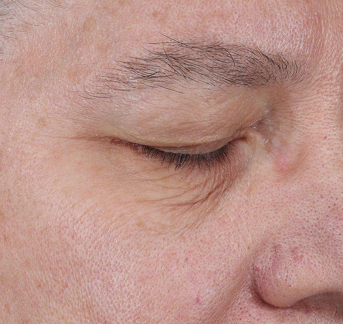 Obagi Medical ELASTIderm Lift & Sculpt Facial Moisturizer – lifts, firms, and hydrates with Bi-Mineral Complex