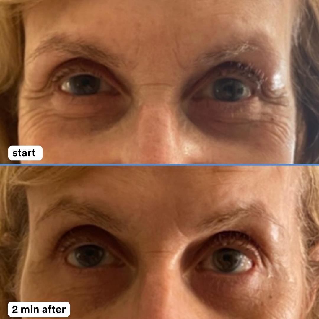 nuorganic Uplifted Instant Firming Eye Cream - Tighten & Lift Firming Eye Cream for Fine Lines and Wrinkles Hydrate Hydrating nuorganic Uplifted Instant Firming Eye Cream - Tighten & Lift Firming Eye Cream for Fine Lines and Wrinkles Hydrate Hydrating