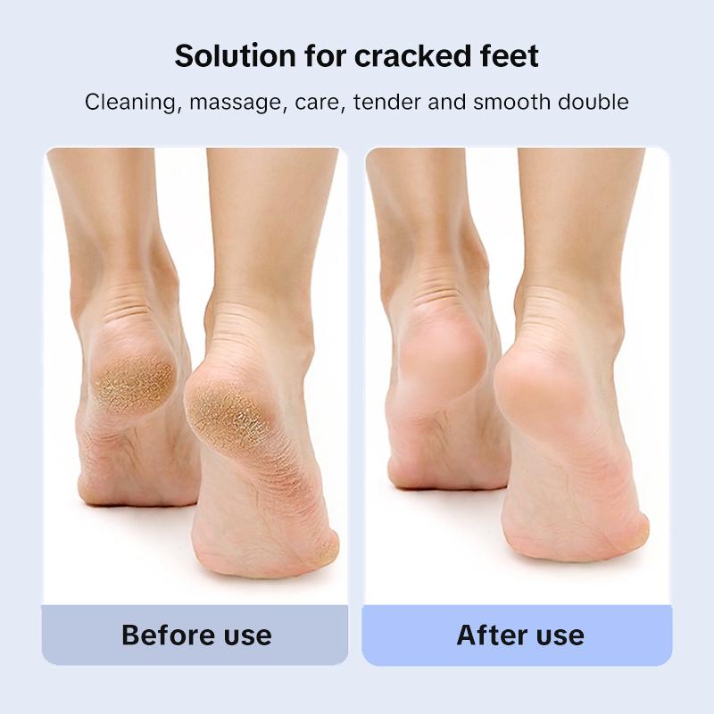 Rechargeable Electric Foot Grinder, Foldable & Waterproof, Professional Pedicure Tool for Smooth Heels