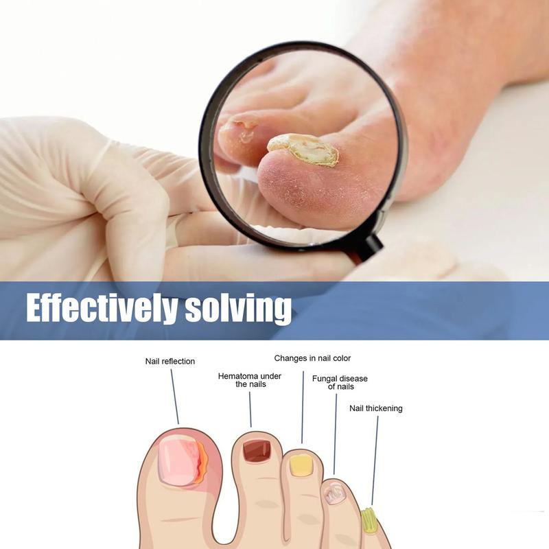 Nail Fungus Treatment – Triple-Action Repair for Brittle, Thick & Discolored Nails – Ginger & Undecylenic Acid Formula, Fast-Acting, Vegan & Cruelty-Free