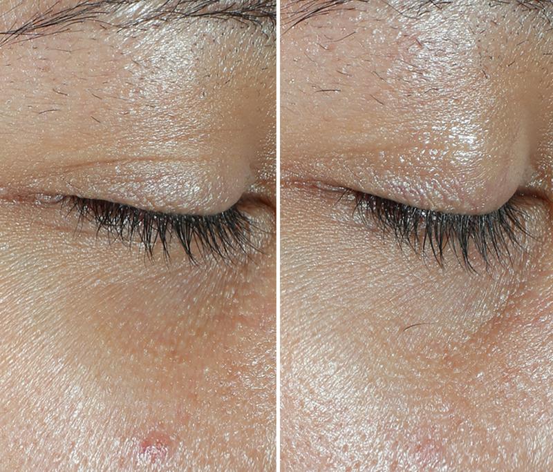 [RoC Skincare] MULTI CORREXION Revive + Glow Eye Balm