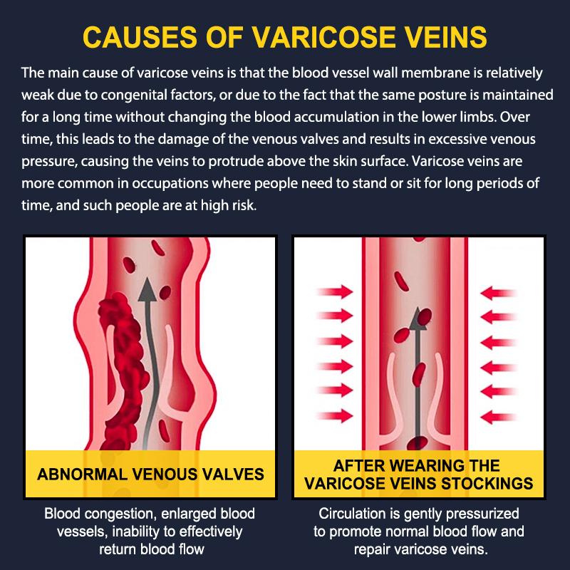 Tinylemon 3 Pairs Calf Compression Sleeves 20-25mmHg for Women Men Leg Support Running Shin Splints Relief Knee Saver Wellknee Plaster Black Healthcare Tool Patellaband