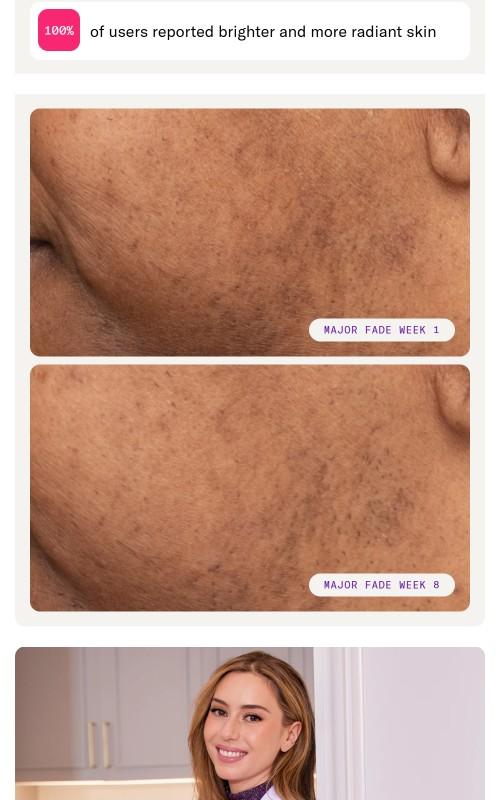 Major Fade Discoloration Duo - Daily Serum & Vitamin C Hydrating Moisturizer for Fading all Types of Discoloration