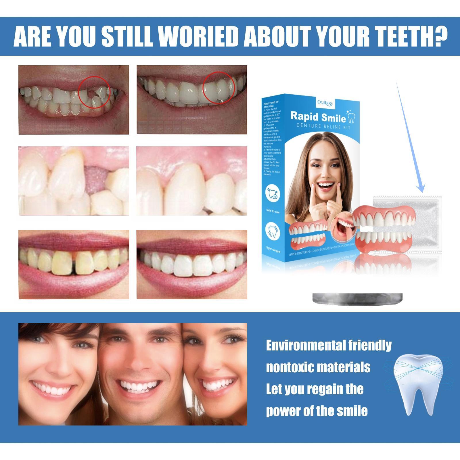 Comfortable and Adjustable Denture Sets, Perfect White Veneers, Create A Professional Smile, Travel Accessories，Upper and lower denture plates can be shaped, and the white particles are filling materials.