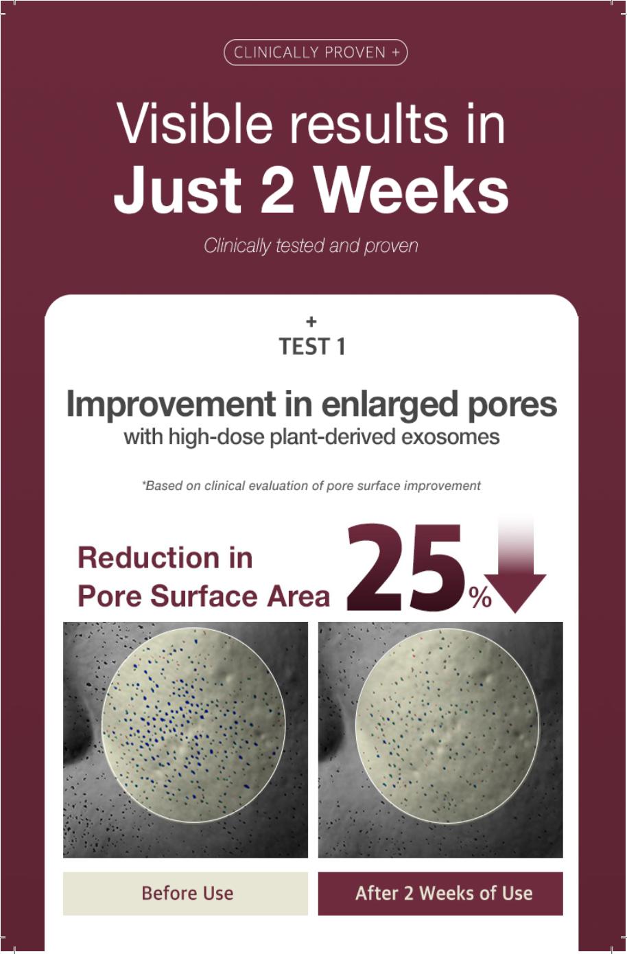 KI Stem-Cell Exosome Booster Kit + 5 Akatsuki White tomato Masks - Anti-Aging & Brightening Ampoule Set with Exosome Solution & Syringe for Radiant Skin Skincare Set Serum Essence