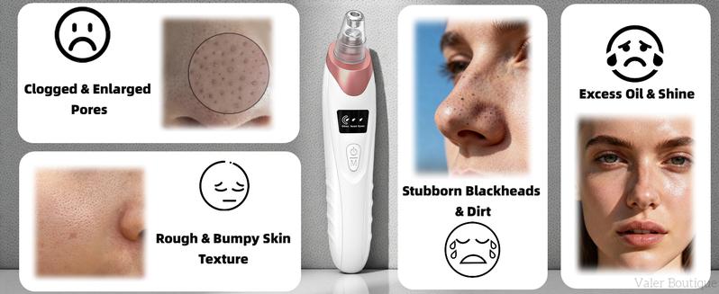 Blackhead Remover Pore Vacuum USB Rechargeable Blackhead extractor Facial Beauty Instrument Facial Beauty