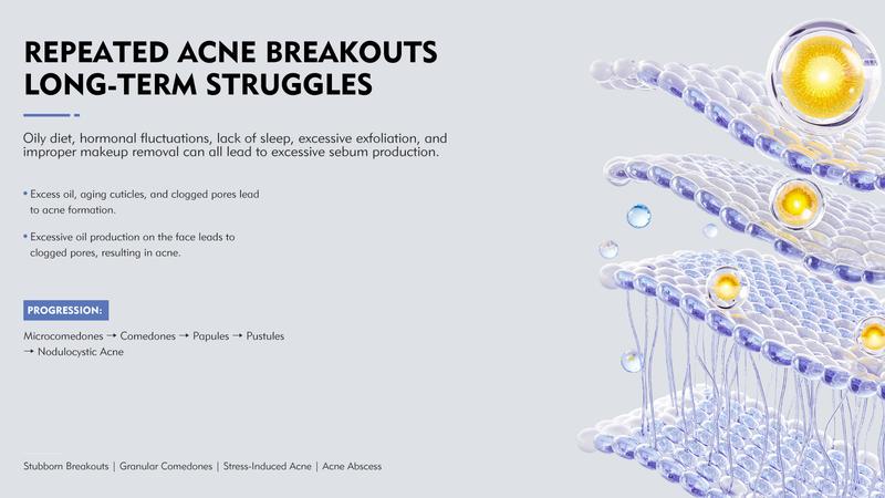 KOSHINÉ KX-826 Anti-Acne Gel | Advanced Skincare for Clearer, Balanced Skin Suitable for Men and Women(50ml))