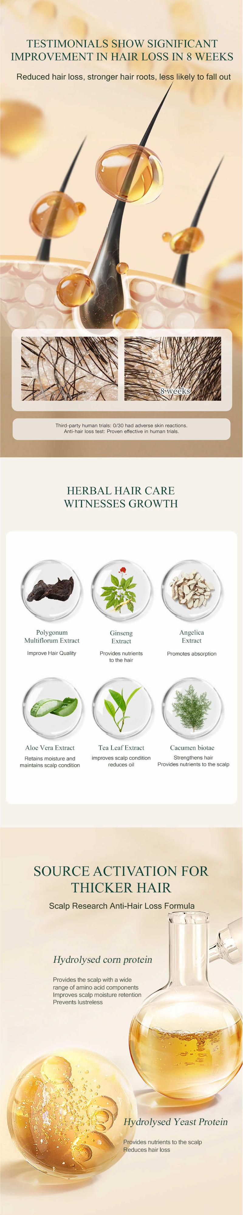 Sipimo Anti  Loss Essence Oil Promotes Healthy  Growth And Restores Dry And Damaged Care, Haircare Comfort Scalp Stimulator  Growth Oil Blend With Ginseng And Polygonum Multiflorum For Nourishing And Hydrating All Types Repair Spray