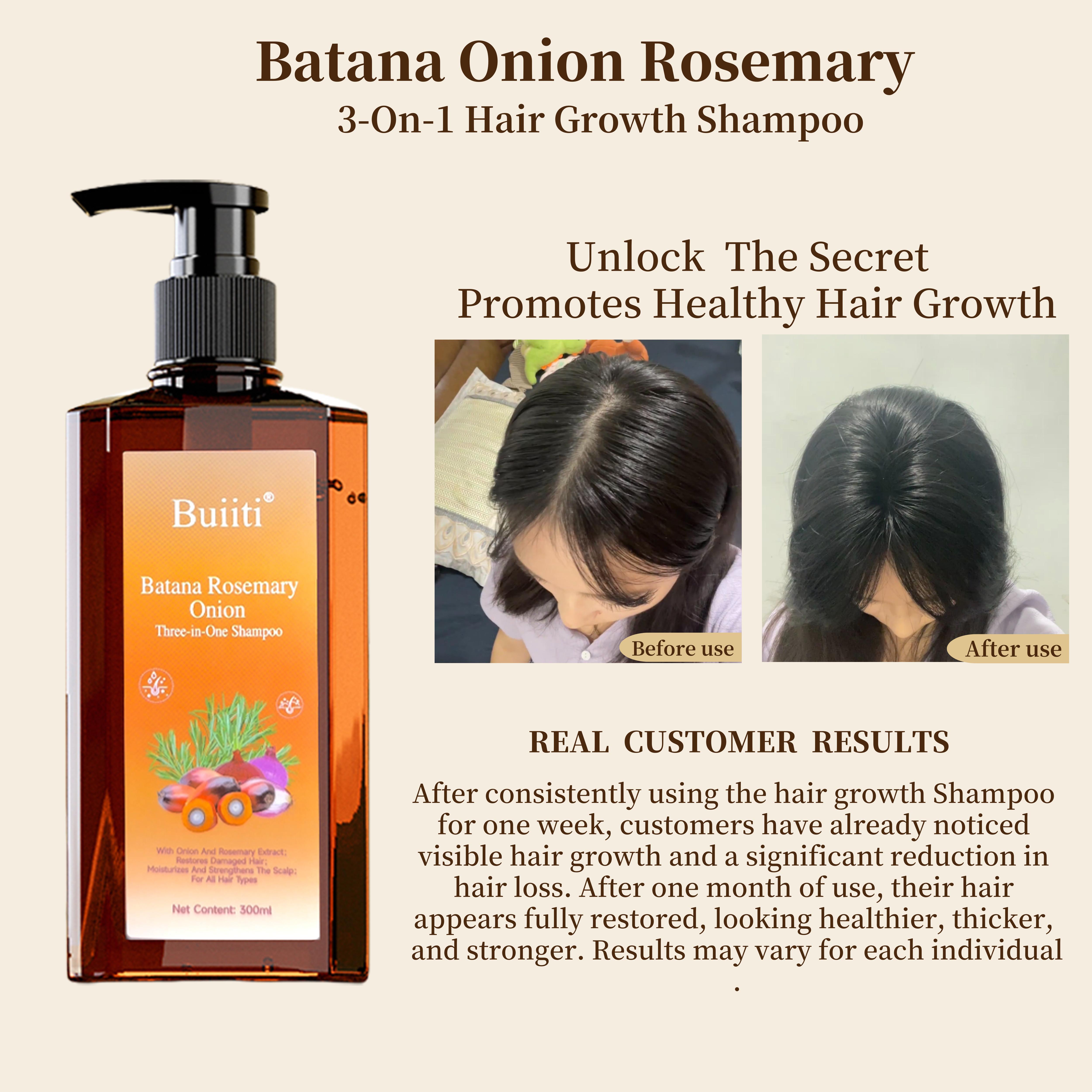 【Buy 1 Get 1 Free】Buiiti Batana Rosemary Onion Three - in - One Anti-Hair Fall HairLoss Treatment Shampoo,Oil Control Antidandruff Haircare,Help HairGrowth For all hair types, natural Haircare