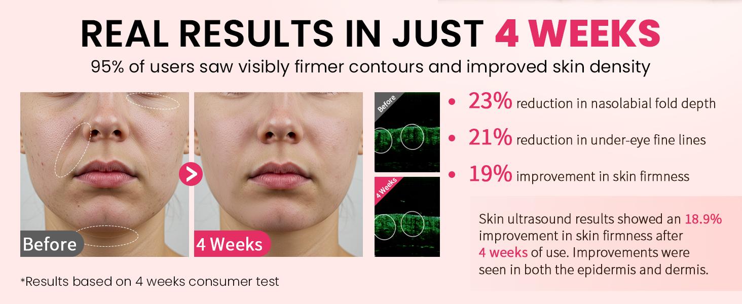 Face Lift Device – 8 in 1 Skin Tighten and Lift, LED Light Therapy for Wrinkles, Korean Skin Care, Spa-Grade Facial Massager Lift & Firm Beauty Massager (White)