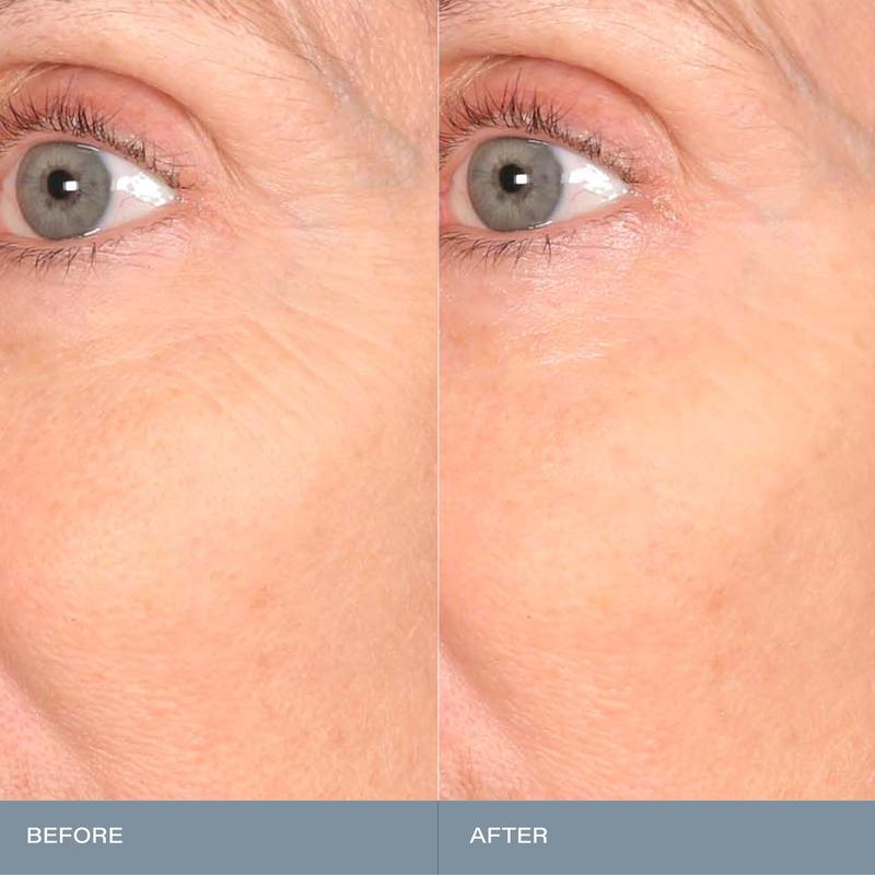 SKINN Cosmetics: Mantle Milk Skin Repair 100 Hours of Hydration - Moisture-Supporting Serum for Enhanced Hydration and Barrier Care Moisturizer Milky