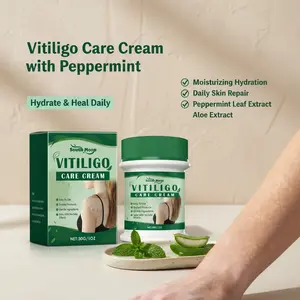 South Moon Vitiligo Care Cream with Peppermint Leaf & Aloe Vera Extract Moisturizing Hydrating Daily Skin Repair Cream for Even Skin Tone