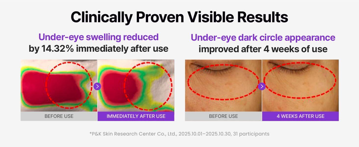 [Centellian24] 360° Shot PDRN Glowing Eye Patch | Brightening & Firming Under-Eye Patches for Dark Circles & Puffiness | TECA + PDRN + Retinol | Korean Skincare | 6.1g × 6ea