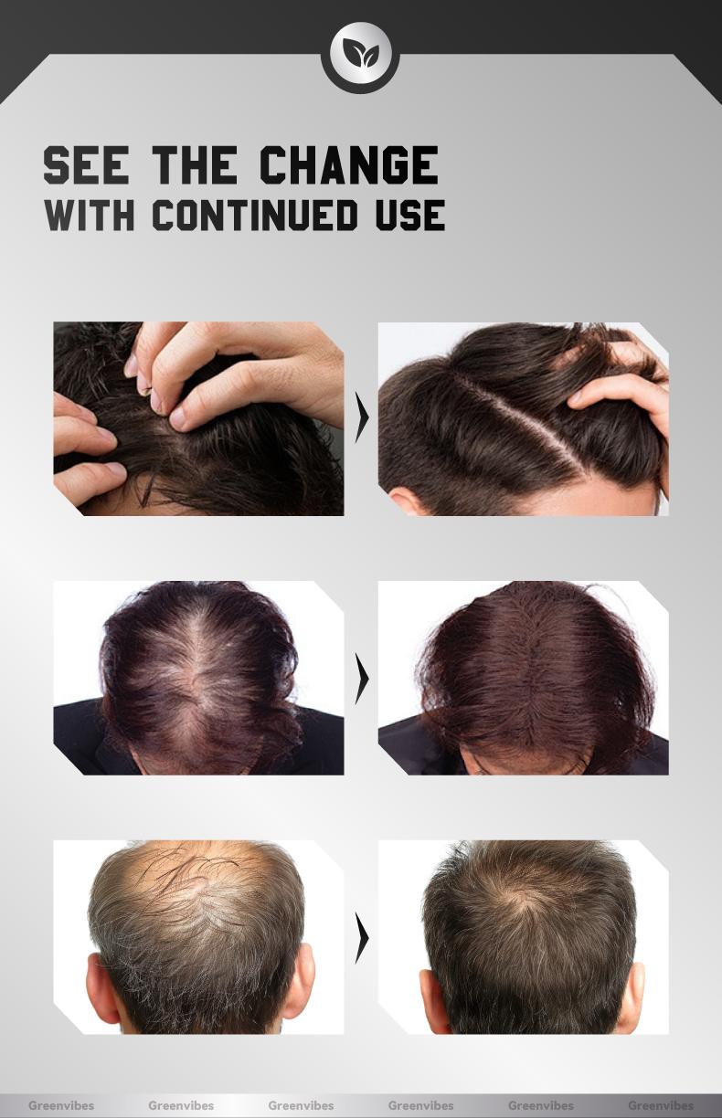 Greenvibes 1 Hair Care Essence  Containing Ingredients such as Butylene Glycol, Glycerin, and Polyaminoglycoside Condensates Enhance Strength and Vitality