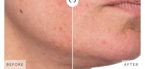 Turmeric Brightening & Exfoliating Scrub + Mask