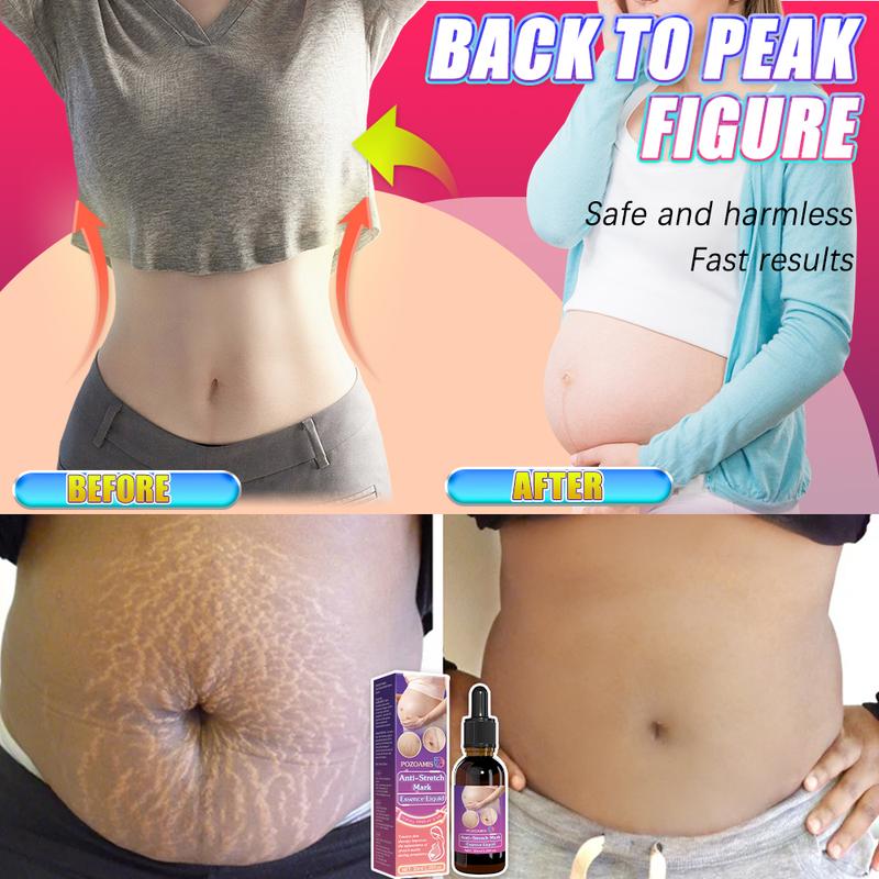 Stretch Mark Repair Serum: Fades stretch marks, moisturizes the skin, and improves skin elasticity. Apply to affected areas to revitalize the skin and prevent the formation of new stretch marks. Stretch Mark Repair Serum: Fades stretch marks, moisturizes the skin, and improves skin elasticity. Apply to affected areas to revitalize the skin and prevent the formation of new stretch marks.